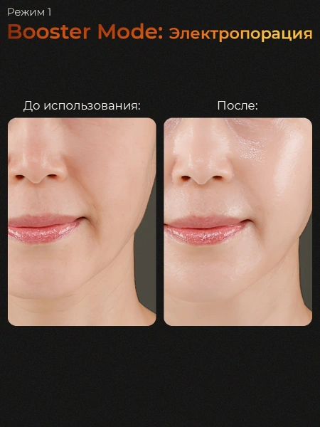 Medicube гаджет для ухода за кожей Age-R Booster Pro Pink