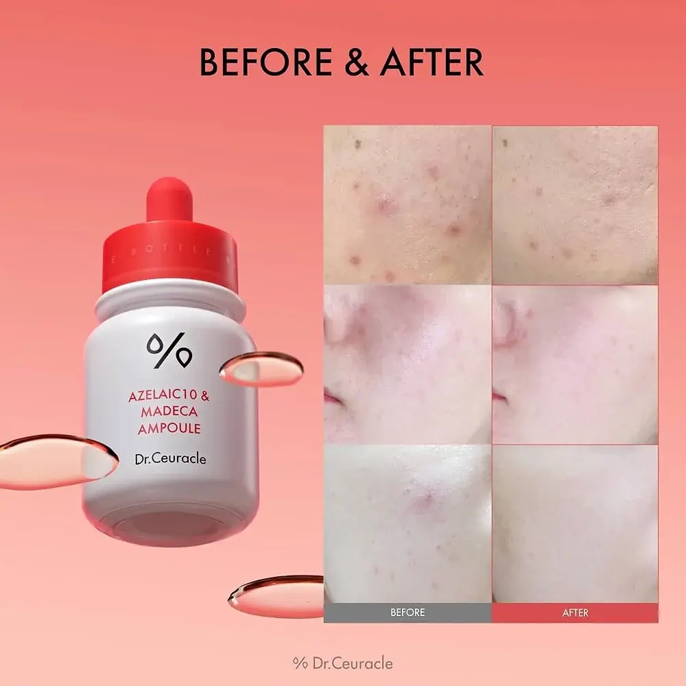 Ампула с 10% азелаиновой кислоты для проблемной кожи Dr.Ceuracle Azelaic 10 & Madeca Ampoule